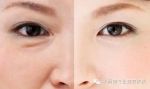 Сыворотка вокруг глаз Collagen Anti-Aging Eye Serum