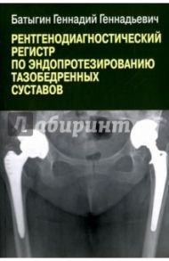 Рентгенологический регистр по эндопротезированию тазобедренных суставов / Батыгин Геннадий Геннадьевич