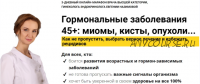 Гормональные заболевания 45+: миомы, кисты, опухоли. Как выбрать верное лечение (Евгения Назимова)